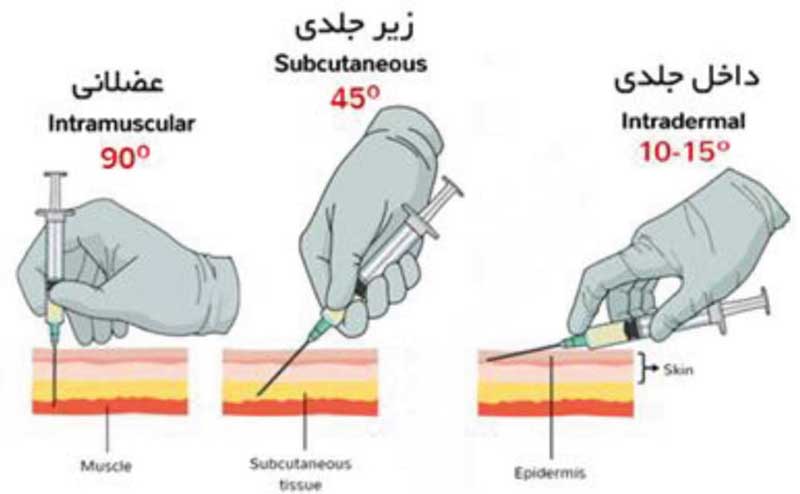 روش های تزریق